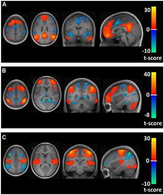 Differences in Resting State Functional Connectivity between Young Adult Endurance Athletes and Healthy Controls